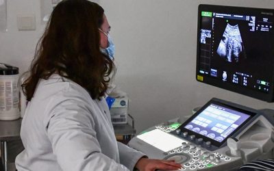 Réalisation d'une échographie