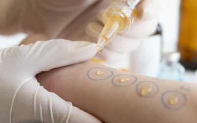 bilan allergologique